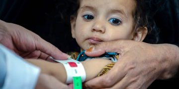 阿富汗飢餓人口8個月內急遽攀升6成，9歲女孩只有3歲身形